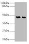 Lecithin-Cholesterol Acyltransferase antibody, A52082-100, Epigentek, Western Blot image 