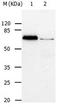 ATP Binding Cassette Subfamily B Member 8 antibody, orb107339, Biorbyt, Western Blot image 