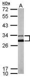 Potassium Voltage-Gated Channel Interacting Protein 2 antibody, GTX116483, GeneTex, Western Blot image 