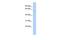 Serine And Arginine Rich Splicing Factor 4 antibody, GTX47362, GeneTex, Western Blot image 