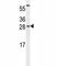 CCAAT Enhancer Binding Protein Gamma antibody, F41065-0.4ML, NSJ Bioreagents, Western Blot image 