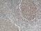 P14151 antibody, 26477-1-AP, Proteintech Group, Immunohistochemistry paraffin image 