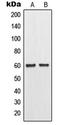 Matrix Metallopeptidase 11 antibody, LS-C352525, Lifespan Biosciences, Western Blot image 