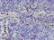 Peptidyl Arginine Deiminase 4 antibody, MA5-26006, Invitrogen Antibodies, Immunohistochemistry frozen image 