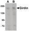 Coiled-Coil Domain Containing 88A antibody, PA5-20869, Invitrogen Antibodies, Western Blot image 