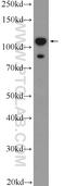 DIS3 Like 3'-5' Exoribonuclease 2 antibody, 25792-1-AP, Proteintech Group, Western Blot image 