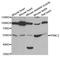 Pyruvate Dehyrogenase Phosphatase Catalytic Subunit 1 antibody, STJ28254, St John