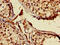 MNAT1 Component Of CDK Activating Kinase antibody, CSB-PA014686LA01HU, Cusabio, Immunohistochemistry frozen image 