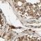 Mitochondrial Ribosomal Protein S22 antibody, PA5-52471, Invitrogen Antibodies, Immunohistochemistry paraffin image 