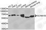 Sodium Channel Epithelial 1 Beta Subunit antibody, A1765, ABclonal Technology, Western Blot image 