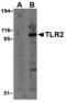Toll Like Receptor 2 antibody, MBS150600, MyBioSource, Western Blot image 