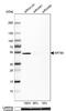 Keratin 80 antibody, NBP2-58851, Novus Biologicals, Western Blot image 