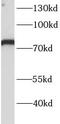 Integrin Alpha FG-GAP Repeat Containing 1 antibody, FNab04410, FineTest, Western Blot image 