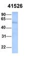 Apolipoprotein E antibody, orb382139, Biorbyt, Western Blot image 