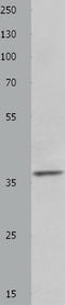 Heme Oxygenase 2 antibody, TA323815, Origene, Western Blot image 
