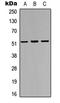 Iroquois-class homeodomain protein IRX-3 antibody, LS-C356132, Lifespan Biosciences, Western Blot image 