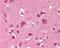 FYN Proto-Oncogene, Src Family Tyrosine Kinase antibody, 49-115, ProSci, Immunohistochemistry paraffin image 