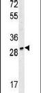 Tryptase Alpha/Beta 1 antibody, PA5-25355, Invitrogen Antibodies, Western Blot image 