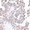 Bromodomain Containing 2 antibody, NBP1-30475, Novus Biologicals, Immunohistochemistry paraffin image 