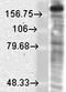 Glutamate Ionotropic Receptor NMDA Type Subunit 2B antibody, orb67425, Biorbyt, Western Blot image 