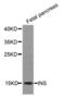 Insulin antibody, abx001702, Abbexa, Western Blot image 
