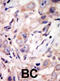 Receptor Tyrosine Kinase Like Orphan Receptor 2 antibody, abx033603, Abbexa, Immunohistochemistry paraffin image 
