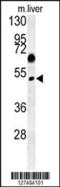 Sorting nexin-31 antibody, 62-123, ProSci, Western Blot image 