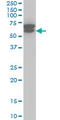 ETS Variant 6 antibody, LS-C133182, Lifespan Biosciences, Western Blot image 