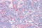 Galectin 9 antibody, MBS247085, MyBioSource, Immunohistochemistry frozen image 
