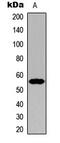 Cytochrome P450 Family 21 Subfamily A Member 2 antibody, abx121587, Abbexa, Western Blot image 