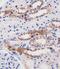 Malic Enzyme 2 antibody, M01380, Boster Biological Technology, Immunohistochemistry paraffin image 