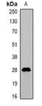 Prodynorphin antibody, abx142135, Abbexa, Western Blot image 