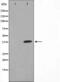 JunB Proto-Oncogene, AP-1 Transcription Factor Subunit antibody, abx011037, Abbexa, Western Blot image 