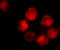 ADAM Metallopeptidase Domain 10 antibody, A00566-2, Boster Biological Technology, Immunofluorescence image 