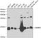 Cellular Retinoic Acid Binding Protein 2 antibody, A6119, ABclonal Technology, Western Blot image 