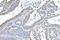 C-Terminal Binding Protein 2 antibody, M02567-1, Boster Biological Technology, Immunohistochemistry paraffin image 