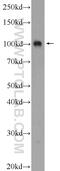 PWP2 Small Subunit Processome Component antibody, 11390-1-AP, Proteintech Group, Western Blot image 