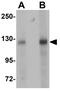 BCAS3 Microtubule Associated Cell Migration Factor antibody, GTX31983, GeneTex, Western Blot image 