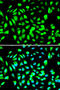 Protein Arginine Methyltransferase 5 antibody, A00635-2, Boster Biological Technology, Western Blot image 