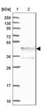 Synaptonemal Complex Central Element Protein 1 antibody, NBP1-88971, Novus Biologicals, Western Blot image 