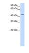 Sulfotransferase Family 2B Member 1 antibody, NBP1-54827, Novus Biologicals, Western Blot image 