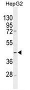 Trimethyllysine Hydroxylase, Epsilon antibody, AP54290PU-N, Origene, Western Blot image 