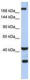 Protein dispatched homolog 1 antibody, TA339637, Origene, Western Blot image 
