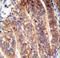 NUMB Endocytic Adaptor Protein antibody, LS-C163064, Lifespan Biosciences, Immunohistochemistry paraffin image 