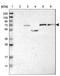 Guanylate Cyclase 1 Soluble Subunit Beta 1 antibody, NBP1-89784, Novus Biologicals, Western Blot image 