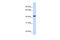 CLN8 Transmembrane ER And ERGIC Protein antibody, ARP49408_P050, Aviva Systems Biology, Western Blot image 