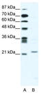 Twist Family BHLH Transcription Factor 1 antibody, TA335179, Origene, Western Blot image 
