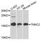 Troponin C2, Fast Skeletal Type antibody, A10108, Boster Biological Technology, Western Blot image 