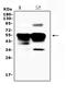 Ring Finger Protein 7 antibody, A03775, Boster Biological Technology, Western Blot image 