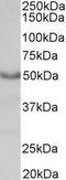 Acetylcholine Receptor antibody, LS-C54654, Lifespan Biosciences, Western Blot image 